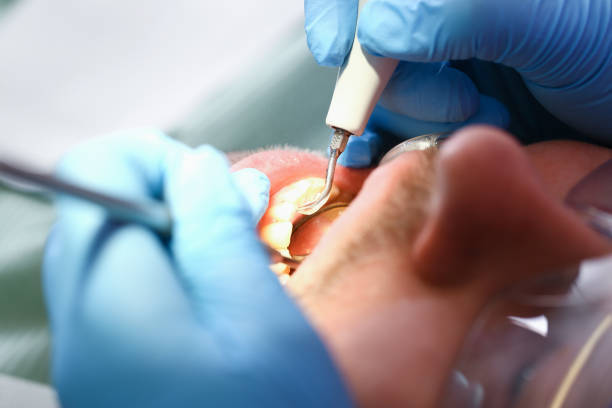 Best Emergency Dental Care for Broken or Chipped Teeth in Kenosha, WI