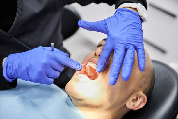 Best Emergency Dental Care for Broken or Chipped Teeth in Kenosha, WI